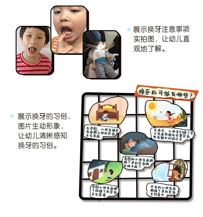 我换牙啦主题墙_详情页_03.png